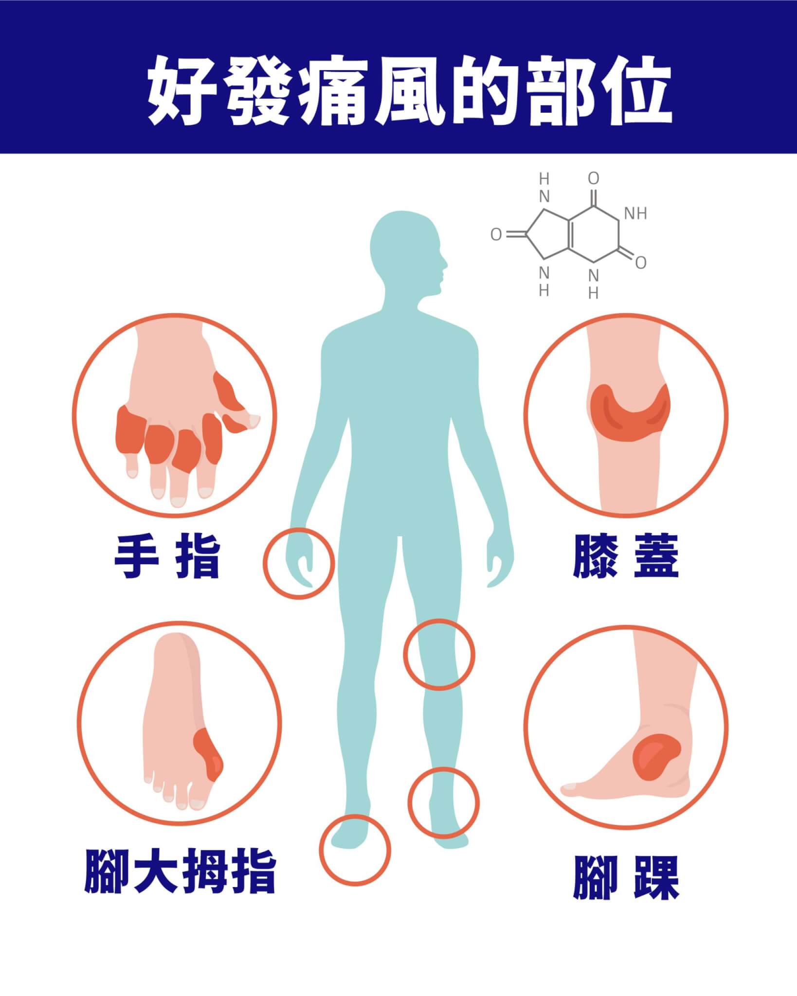 痛風部位