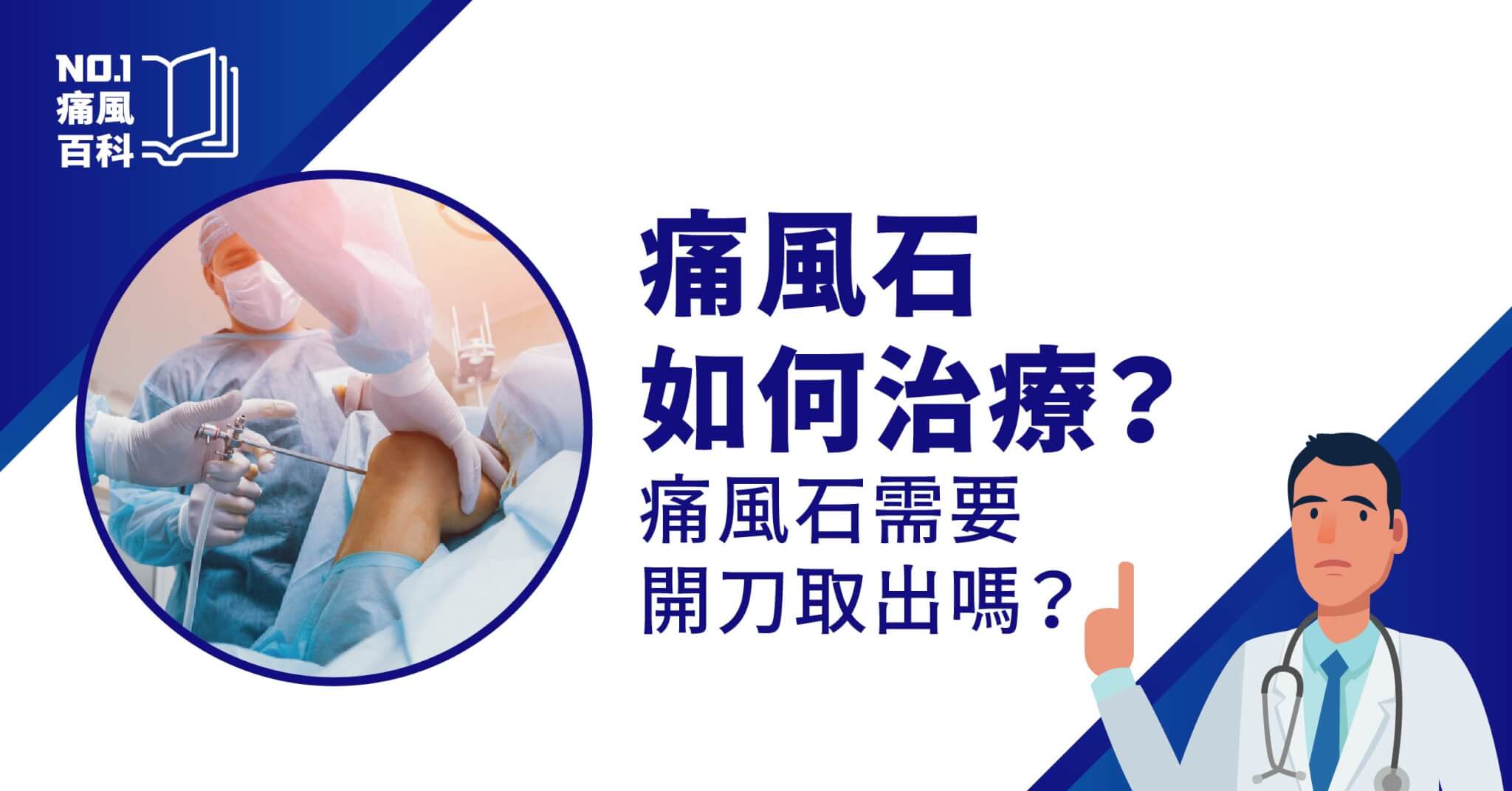痛風石手術費用