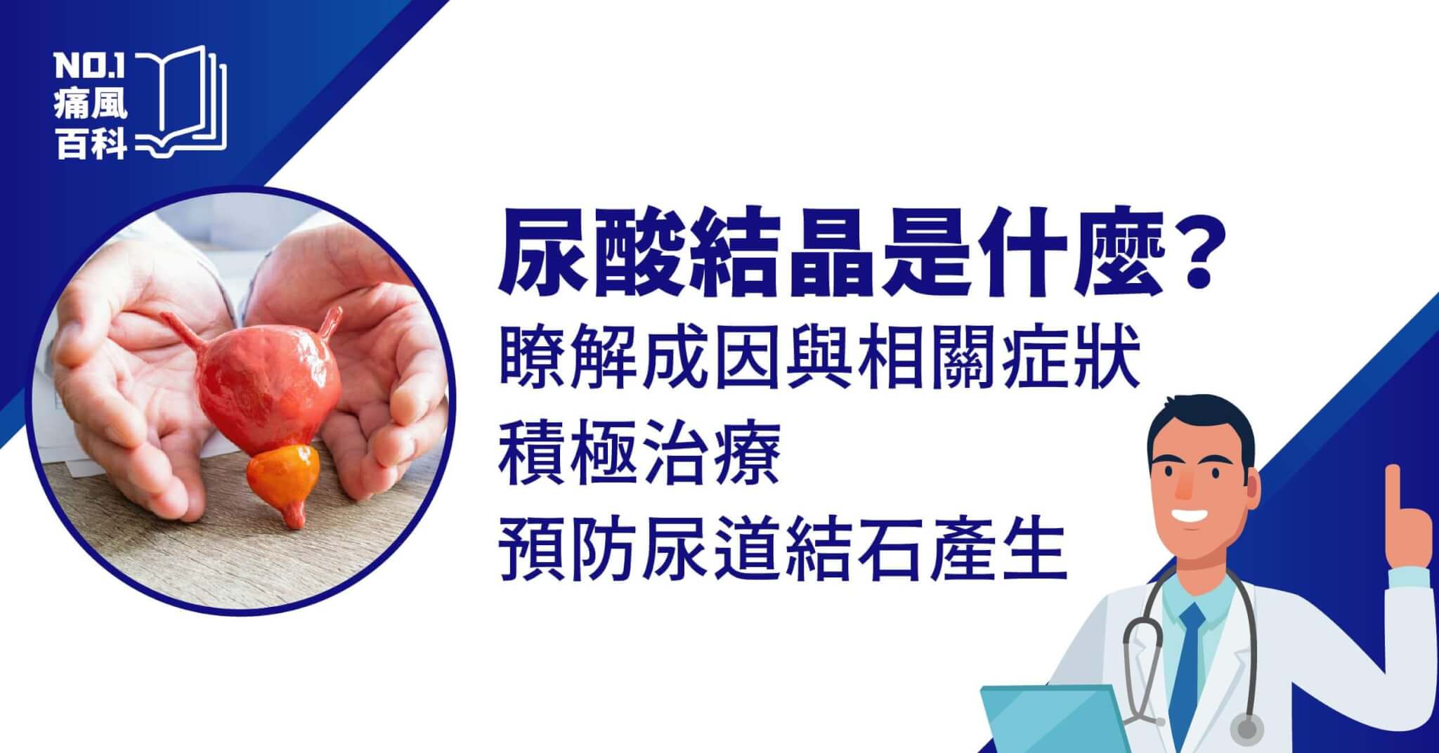 尿酸結晶是什麼？為什麼會造成尿道結石？